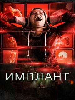 Постер: Имплант